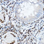 Immunohistochemistry - Anti-PKC beta Antibody (A91183) - Antibodies.com