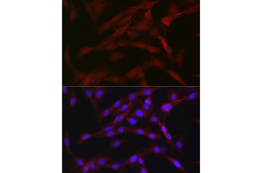 Immunofluorescence - Anti-PKC beta Antibody (A91183) - Antibodies.com