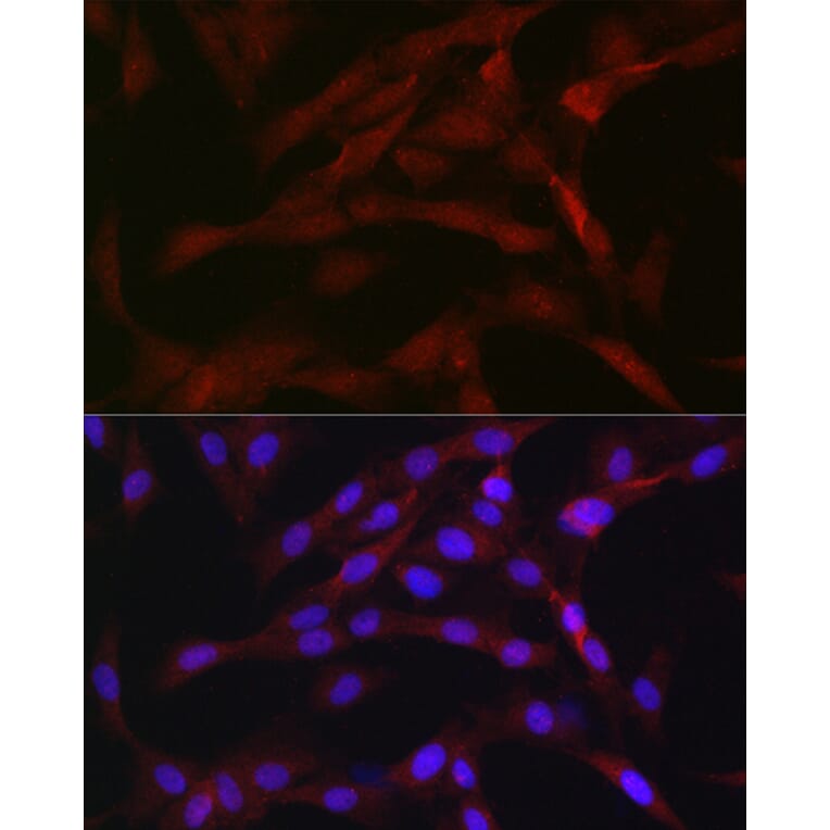 Immunofluorescence - Anti-PKC beta Antibody (A91183) - Antibodies.com