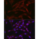Immunofluorescence - Anti-PKC beta Antibody (A91183) - Antibodies.com