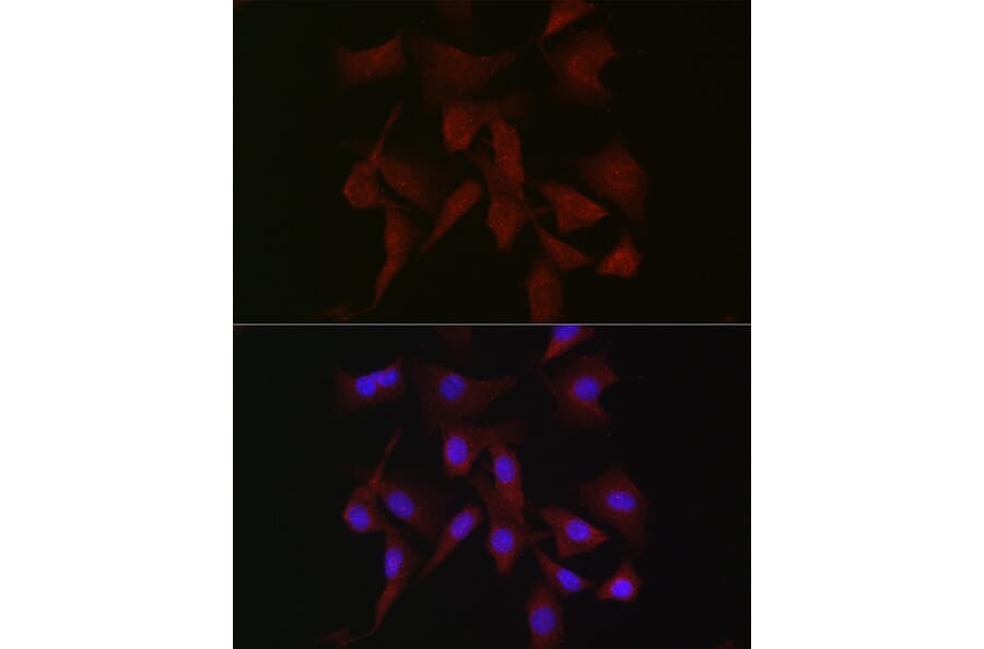 Immunofluorescence - Anti-PKC beta Antibody (A91183) - Antibodies.com