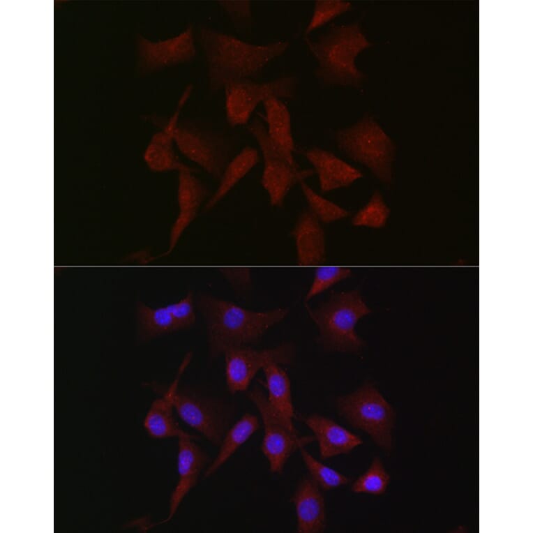 Immunofluorescence - Anti-PKC beta Antibody (A91183) - Antibodies.com