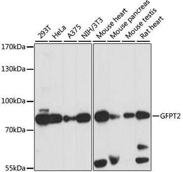 Western blot analysis of extracts of various cell lines, using Anti-GFPT2 Antibody (A15374) at 1:1,000 dilution.
Secondary antibody: Goat Anti-Rabbit IgG (H+L) (HRP) (AS014) at 1:10,000 dilution.
Lysates / proteins: 25µg per lane.
Blocking buffer: 3% non-fat dry milk in TBST.
Detection: ECL Basic Kit (RM00020).
Exposure time: 3s.
