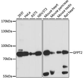 Western Blot - Anti-GFPT2 Antibody (A91184) - Antibodies.com