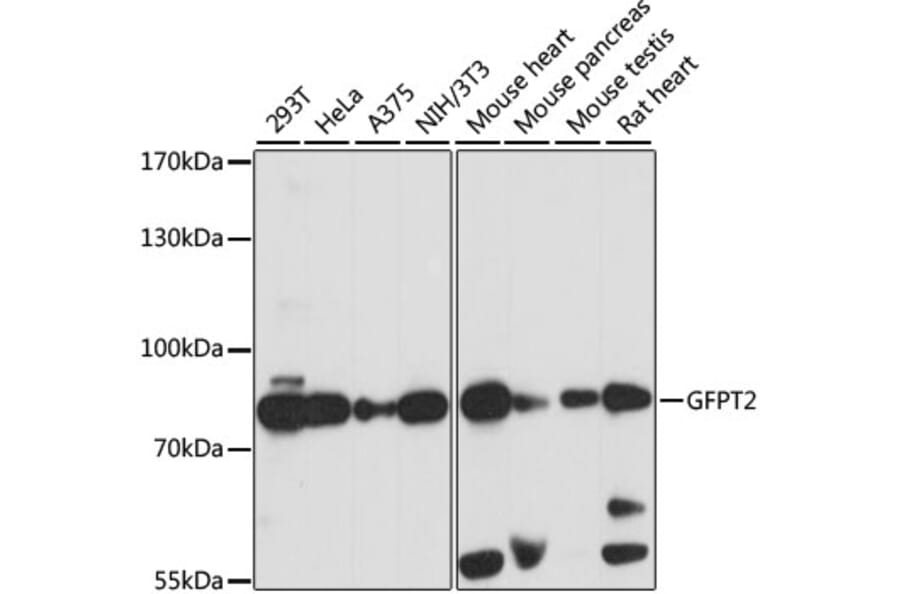 Western Blot - Anti-GFPT2 Antibody (A91184) - Antibodies.com