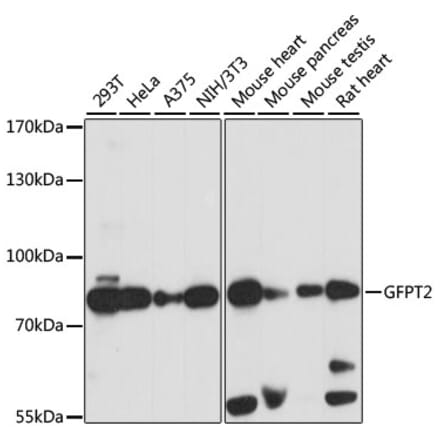 Western Blot - Anti-GFPT2 Antibody (A91184) - Antibodies.com