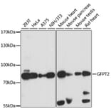 Western Blot - Anti-GFPT2 Antibody (A91184) - Antibodies.com