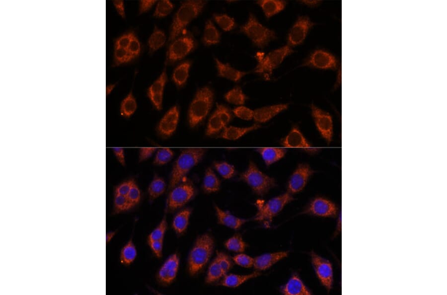 Immunofluorescence - Anti-GFPT2 Antibody (A91184) - Antibodies.com