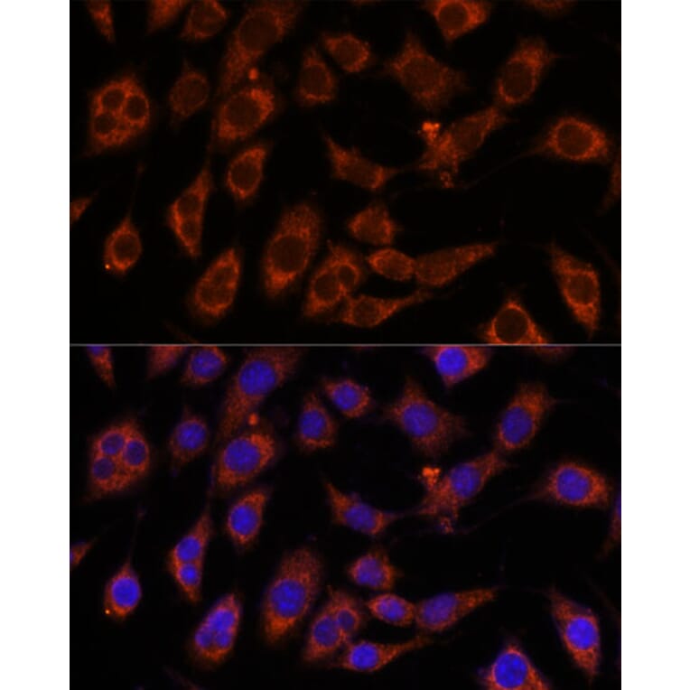 Immunofluorescence - Anti-GFPT2 Antibody (A91184) - Antibodies.com