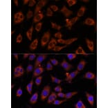 Immunofluorescence - Anti-GFPT2 Antibody (A91184) - Antibodies.com