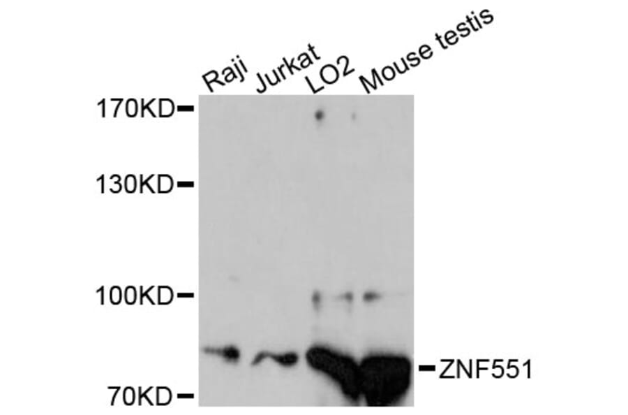 Western Blot - Anti-ZNF551 Antibody (A13780) - Antibodies.com