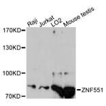 Western Blot - Anti-ZNF551 Antibody (A13780) - Antibodies.com