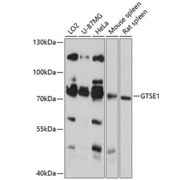 Western Blot - Anti-GTSE1 Antibody (A91186) - Antibodies.com