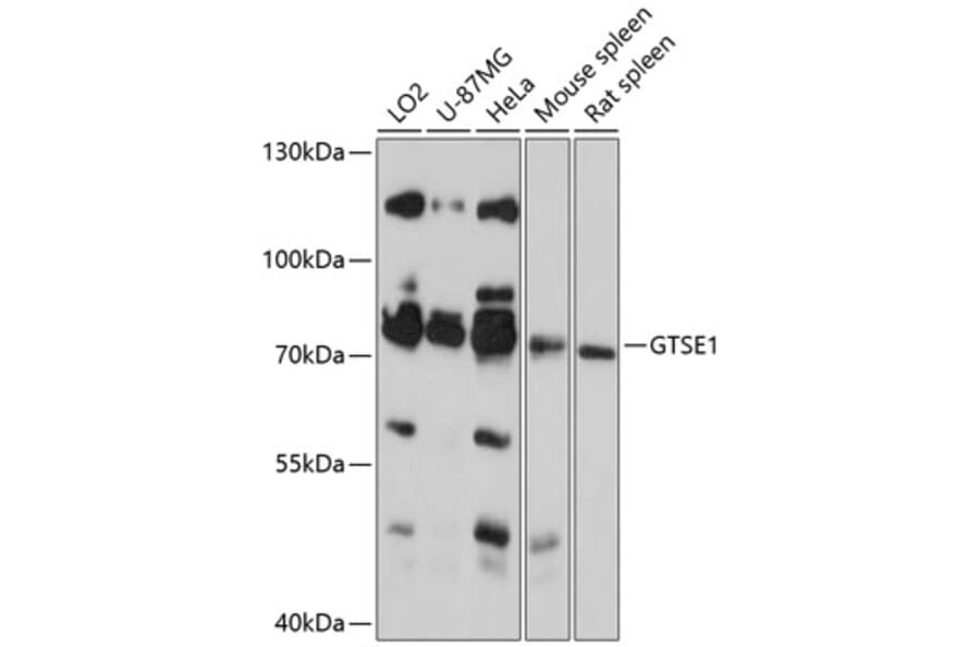 Western Blot - Anti-GTSE1 Antibody (A91186) - Antibodies.com