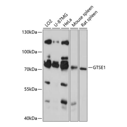 Western Blot - Anti-GTSE1 Antibody (A91186) - Antibodies.com