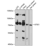 Western Blot - Anti-GTSE1 Antibody (A91186) - Antibodies.com