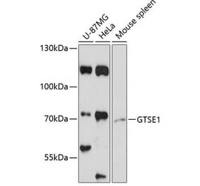 Western Blot - Anti-GTSE1 Antibody (A91187) - Antibodies.com