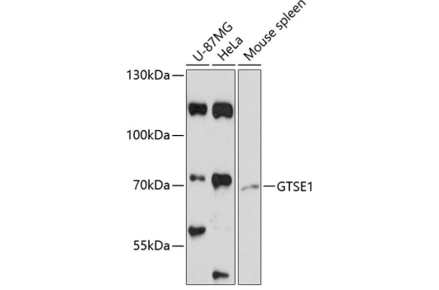 Western Blot - Anti-GTSE1 Antibody (A91187) - Antibodies.com
