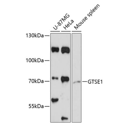 Western Blot - Anti-GTSE1 Antibody (A91187) - Antibodies.com