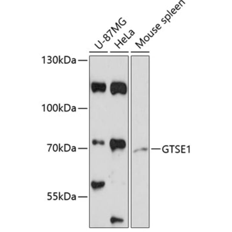 Western Blot - Anti-GTSE1 Antibody (A91187) - Antibodies.com