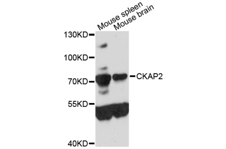 Western Blot - Anti-CKAP2 Antibody (A9706) - Antibodies.com