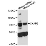 Western Blot - Anti-CKAP2 Antibody (A9706) - Antibodies.com