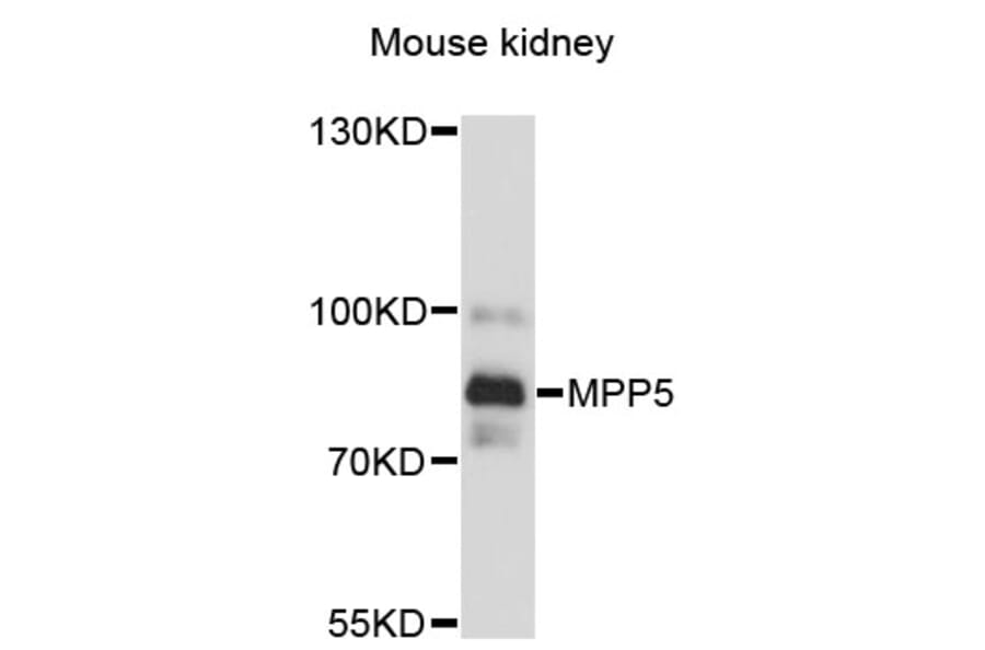 Western Blot - Anti-MPP5 Antibody (A13878) - Antibodies.com
