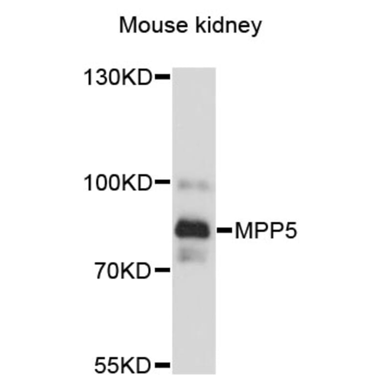 Western Blot - Anti-MPP5 Antibody (A13878) - Antibodies.com