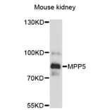 Western Blot - Anti-MPP5 Antibody (A13878) - Antibodies.com