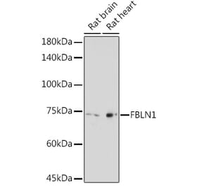 Western Blot - Anti-Fibulin 1 Antibody (A91190) - Antibodies.com