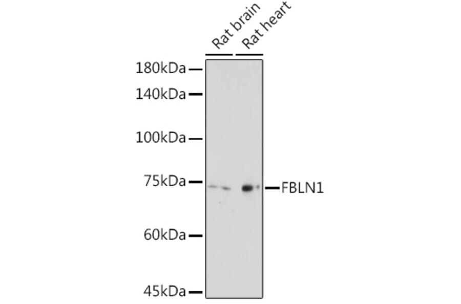 Western Blot - Anti-Fibulin 1 Antibody (A91190) - Antibodies.com