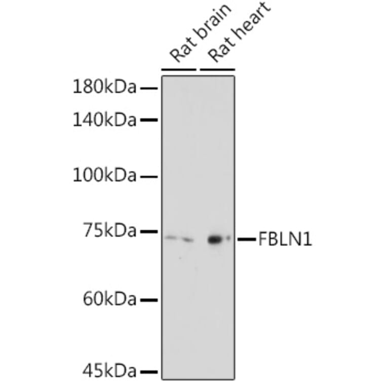 Western Blot - Anti-Fibulin 1 Antibody (A91190) - Antibodies.com