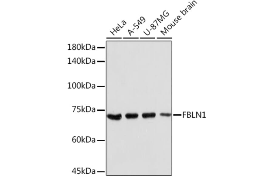 Western Blot - Anti-Fibulin 1 Antibody (A91190) - Antibodies.com