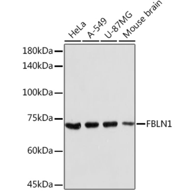 Western Blot - Anti-Fibulin 1 Antibody (A91190) - Antibodies.com