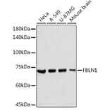 Western Blot - Anti-Fibulin 1 Antibody (A91190) - Antibodies.com