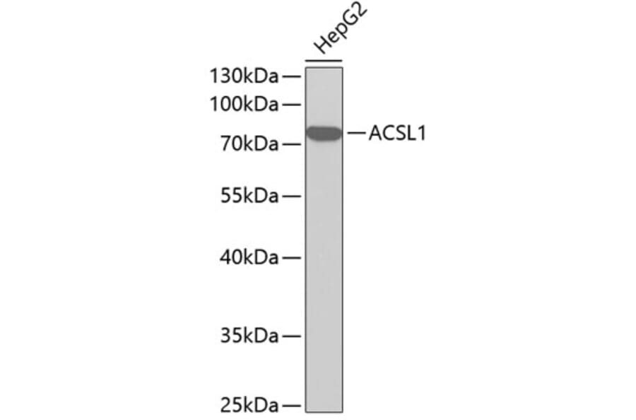 Western Blot - Anti-ACSL1 Antibody (A1000) - Antibodies.com