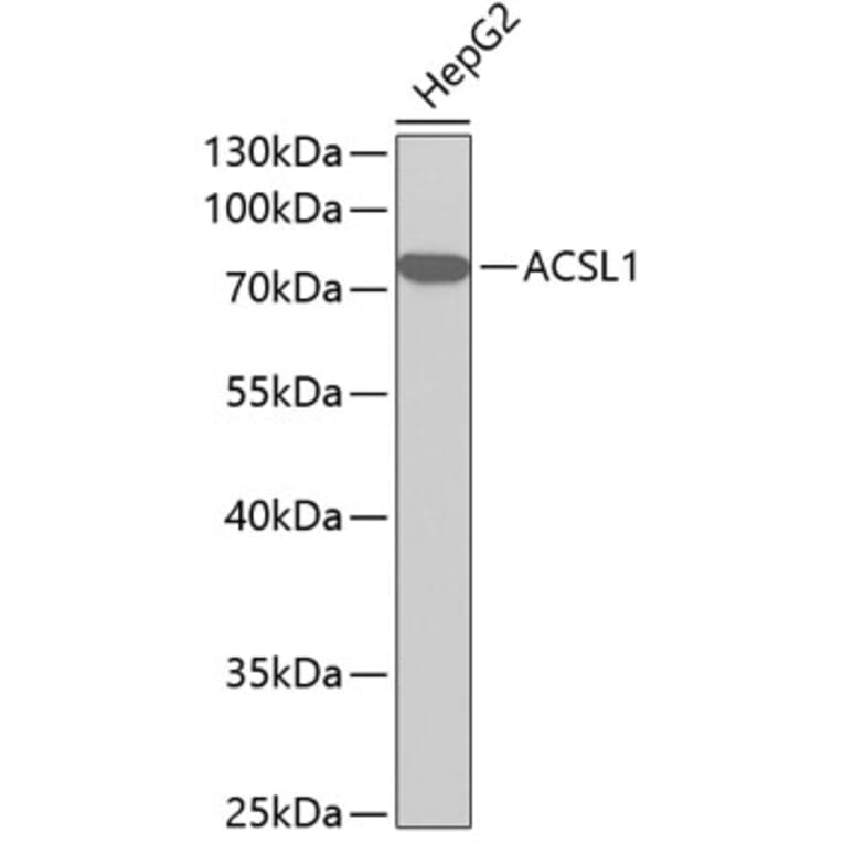 Western Blot - Anti-ACSL1 Antibody (A1000) - Antibodies.com