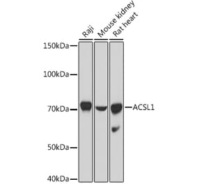 Western Blot - Anti-ACSL1 Antibody (A91192) - Antibodies.com
