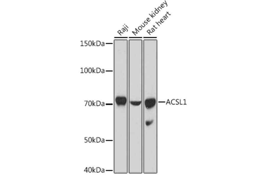 Western Blot - Anti-ACSL1 Antibody (A91192) - Antibodies.com