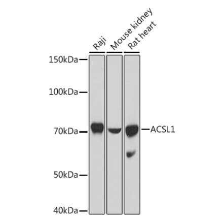 Western Blot - Anti-ACSL1 Antibody (A91192) - Antibodies.com