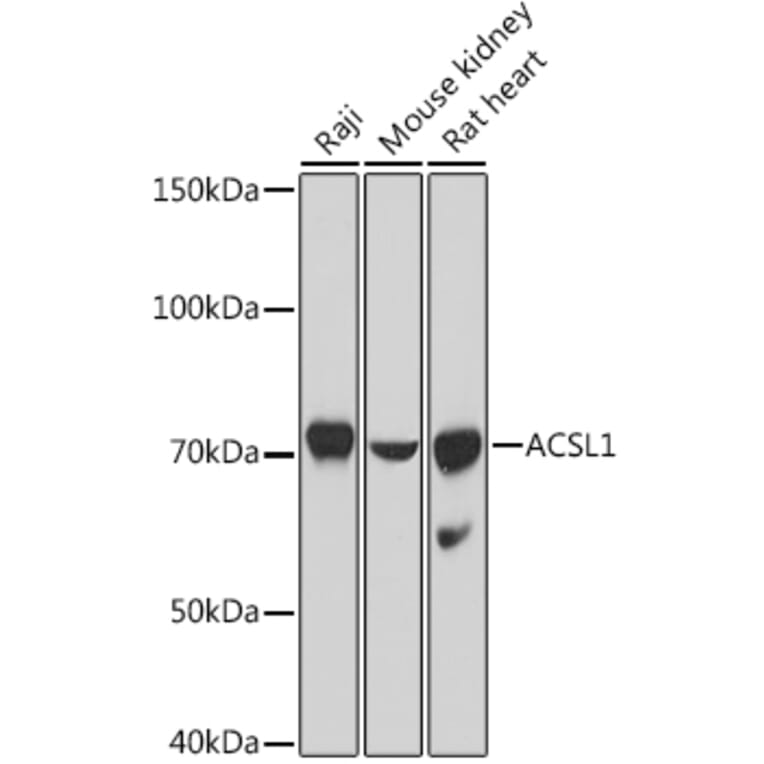 Western Blot - Anti-ACSL1 Antibody (A91192) - Antibodies.com
