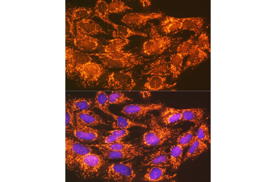 Immunofluorescence - Anti-ACSL1 Antibody (A91192) - Antibodies.com