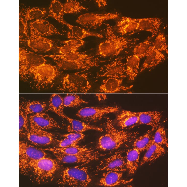 Immunofluorescence - Anti-ACSL1 Antibody (A91192) - Antibodies.com