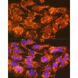 Immunofluorescence - Anti-ACSL1 Antibody (A91192) - Antibodies.com