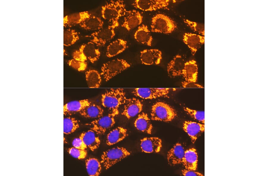 Immunofluorescence - Anti-ACSL1 Antibody (A91192) - Antibodies.com