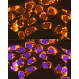 Immunofluorescence - Anti-ACSL1 Antibody (A91192) - Antibodies.com