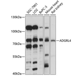 Western Blot - Anti-ETL Antibody (A91193) - Antibodies.com