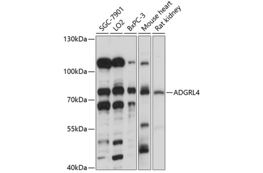 Western Blot - Anti-ETL Antibody (A91193) - Antibodies.com