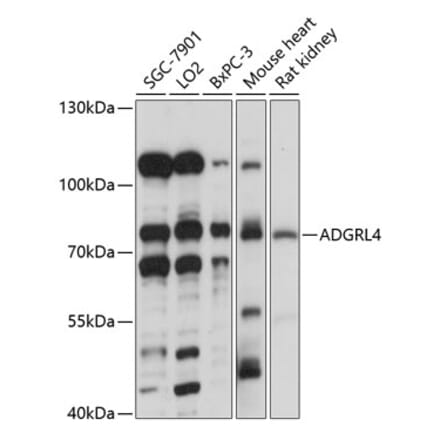 Western Blot - Anti-ETL Antibody (A91193) - Antibodies.com