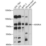 Western Blot - Anti-ETL Antibody (A91193) - Antibodies.com